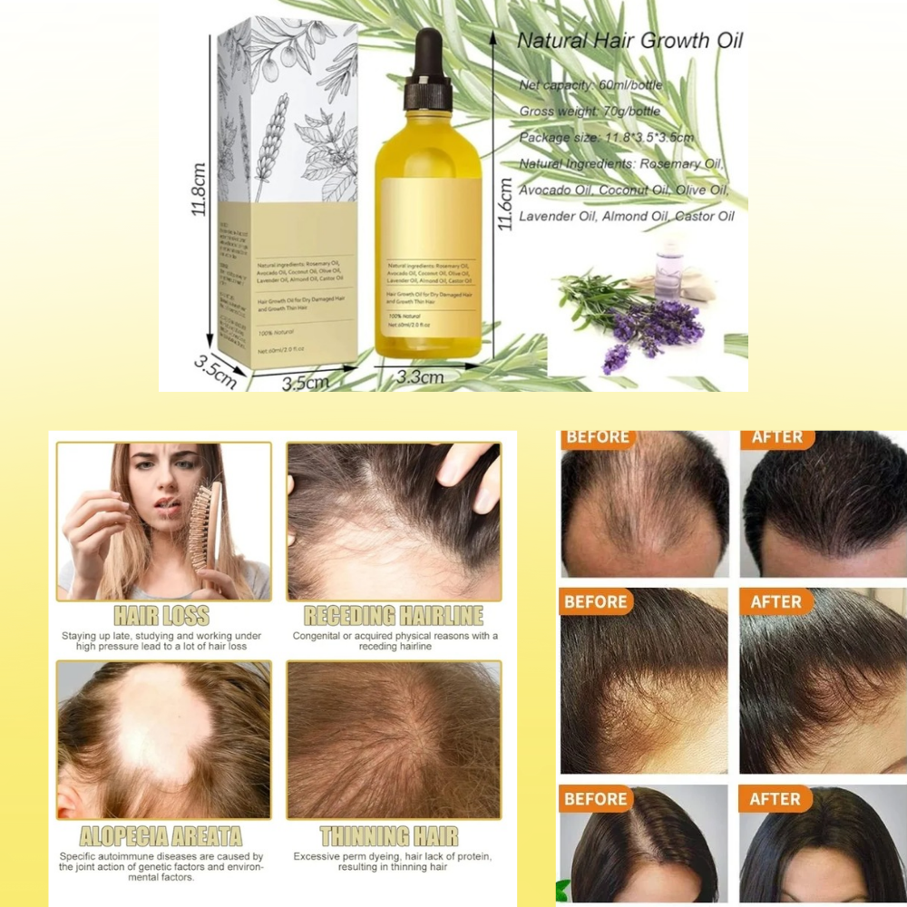 Vegan Natural Hair Growth Oil (Pack of 2)